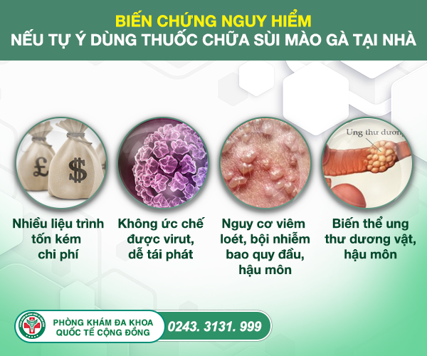 Điều trị bệnh sùi mào gà hiệu quả với 2 phương pháp mới IRA & Ala-Pdt 3