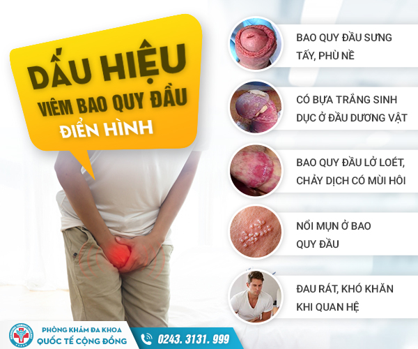Tìm hiểu cách chữa bao quy đầu nổi mụn trắng theo từng nguyên nhân cụ thể