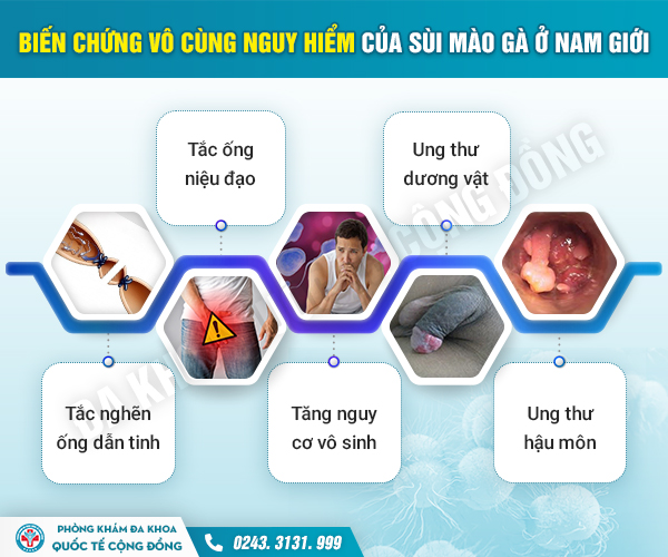 Sùi mào gà để lâu có nguy hiểm? Chi phí đốt sùi mào gà hết bao nhiêu?