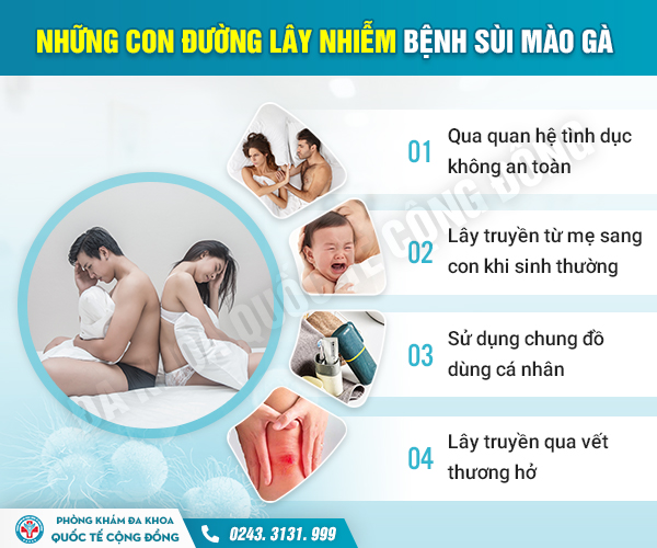 Đốt sùi mào gà có còn là phương pháp chữa bệnh hiệu quả?