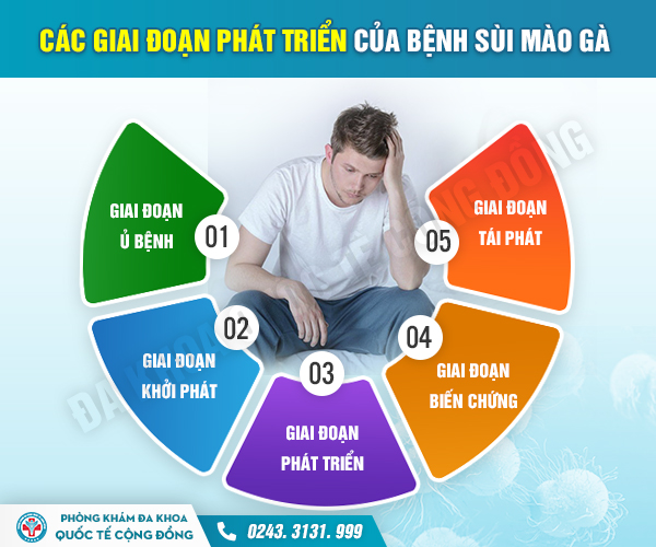 Nhận biết nhanh các giai đoạn sùi mào gà ở nam giới