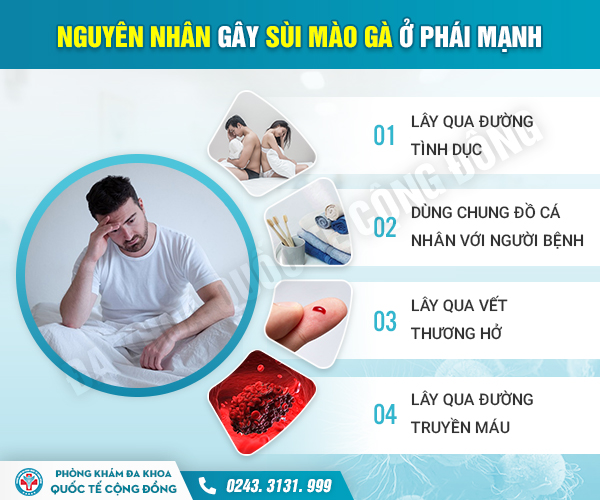 [Gỡ rối thắc mắc] Chữa sùi mào gà tại nhà liệu có mang lại hiệu quả?
