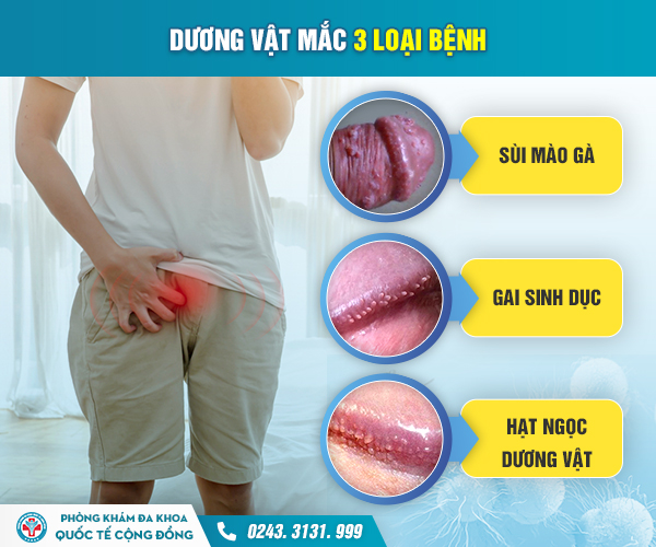 [TỔNG HỢP] Hình ảnh phân biệt sùi mào gà và các bệnh nam khoa khác